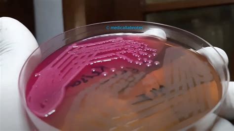 will vibrio grow on blood agar